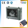 Portable Vet Ultrasound Scanner (THR-2000V)